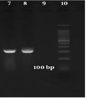 Jundishapur J Microbiol